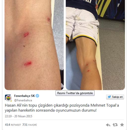 Fenerbahçe'den sert hareket isyanı!