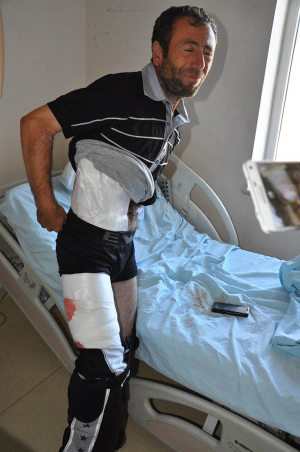 Ayının saldırdığı adam bu hale geldi!