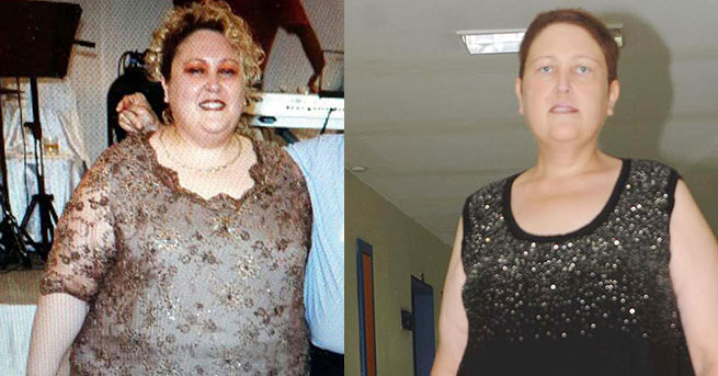 Beş ayda 45 kilo verdi, bakın ne hale geldi