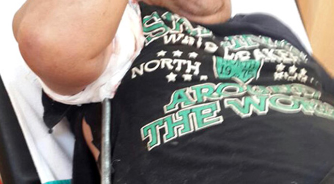 Oto yıkama tabancası vücuduna saplandı