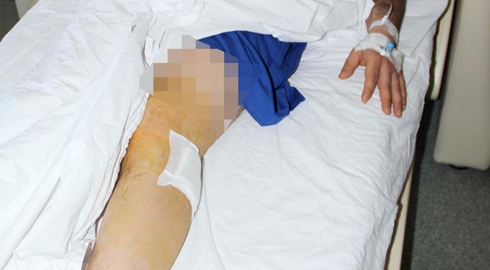 Bacağındaki acının sebebi 15 yıl sonra ortaya çıktı
