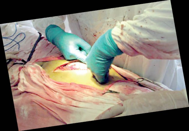 PKK büyük şehirlerin göbeğine tedavi evleri kurdu!