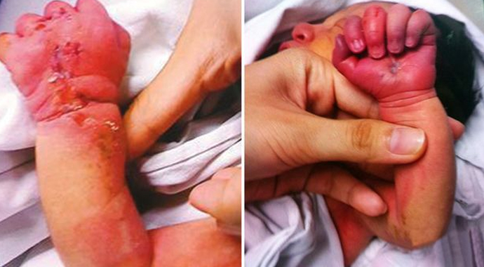 Anne doğurduktan sonra bebeğini yedi!