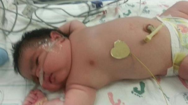 Bu bebek görenleri şaşırtıyor