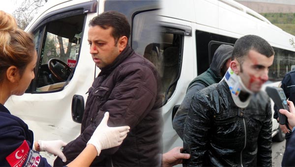 Polisi bile şaşkına çeviren kaza!
