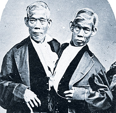 Kaderin birbirine bağladığı kardeşler