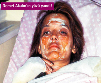 Demet Akalın'dan takipçilerini kızdıran yorum!