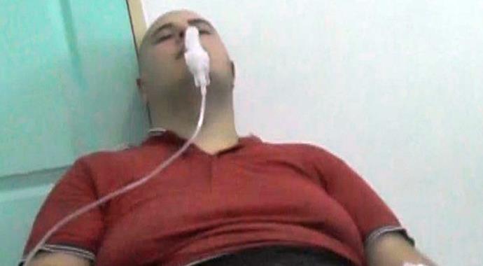 5 yıldızlı otelde asit skandalı