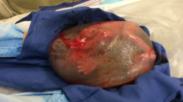 Böyle doğum görülmedi!