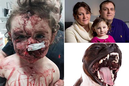 18 aylık bebek köpeğin saldırısına uğradı!