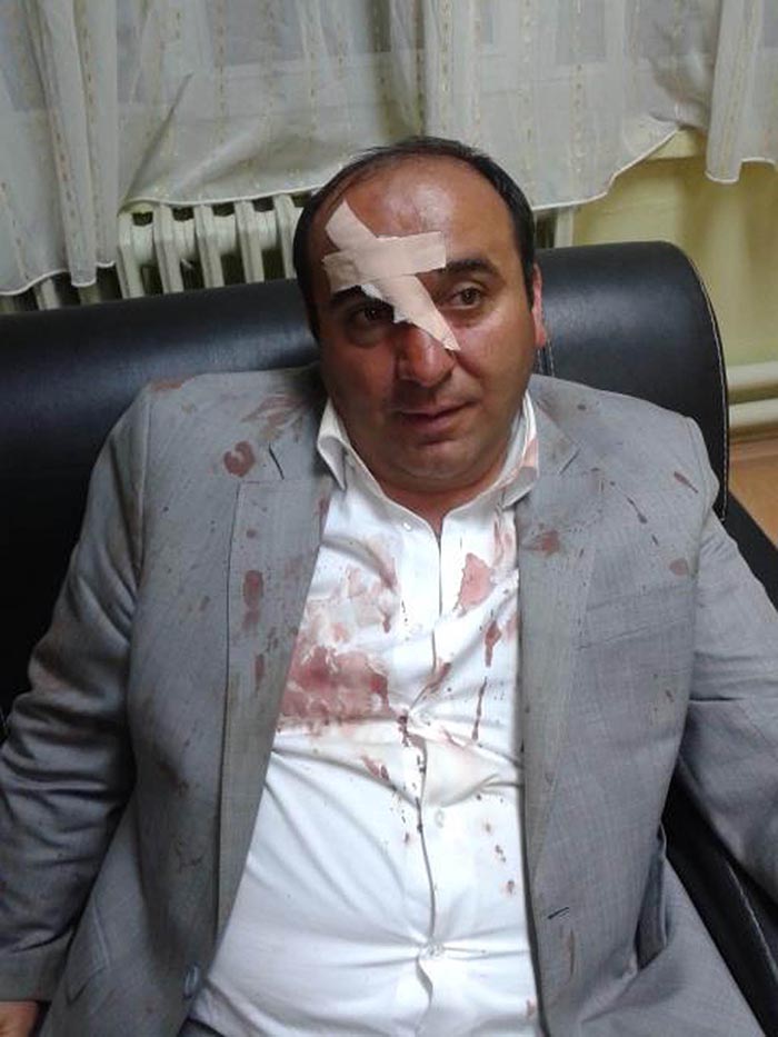 AK Partili başkanı döve döve hastanelik ettiler