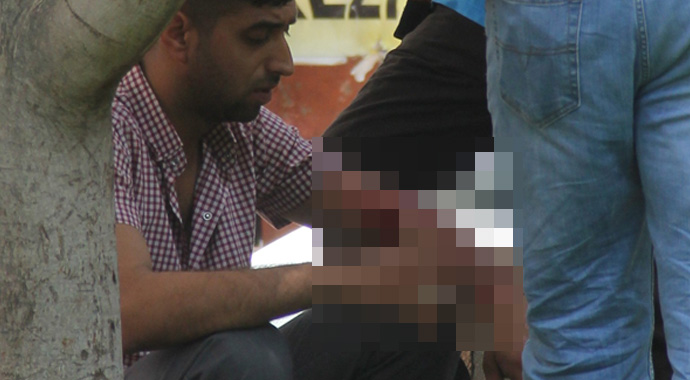 Bıçakla kendini kesti! 'Bu benim hobim'