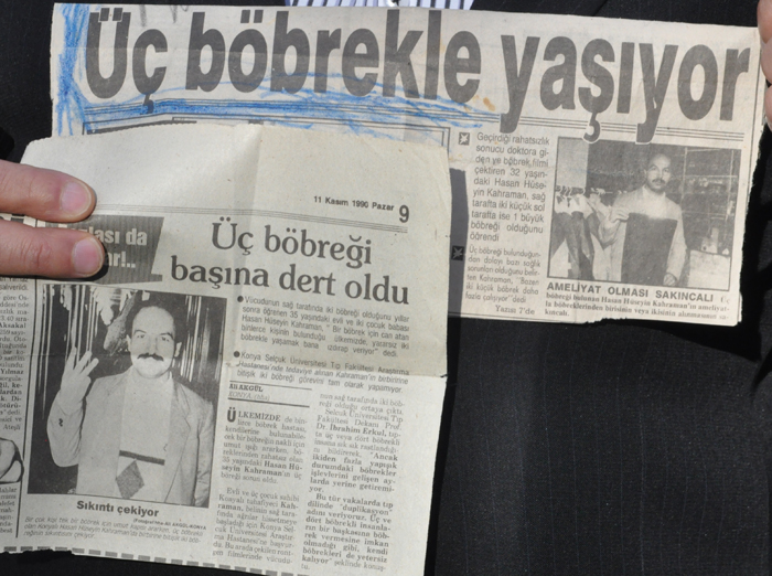 Böbrek kontrolünde fıkraları aratmayan olay!