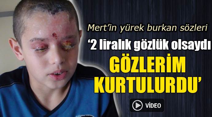 Deney sırasında yaralanan Mert, Fenerbahçe maçında