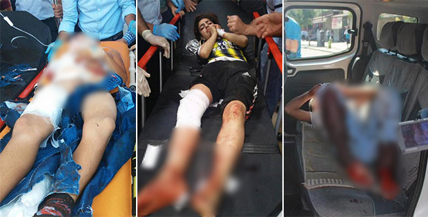 Diyarbakır'da kalleş saldırı: 2'si ağır 5 çocuk yaralı