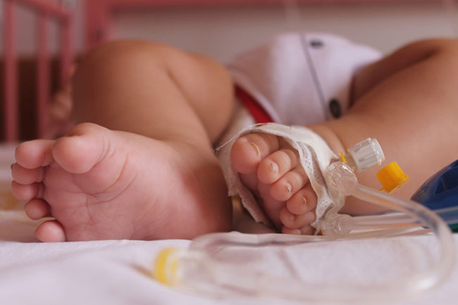 24 parmaklı bebek görenleri şaşırttı