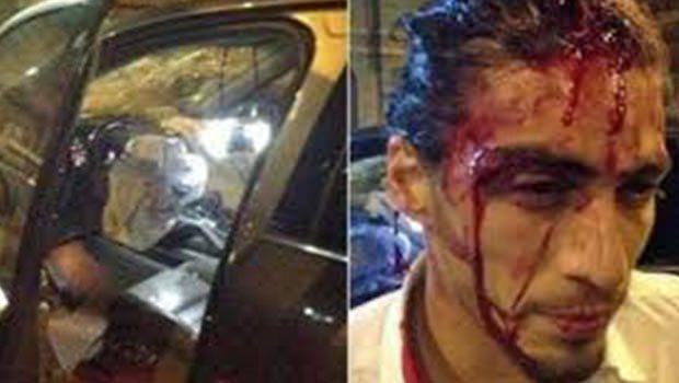 Dünyaca ünlü yıldız trafik kazası geçirdi!