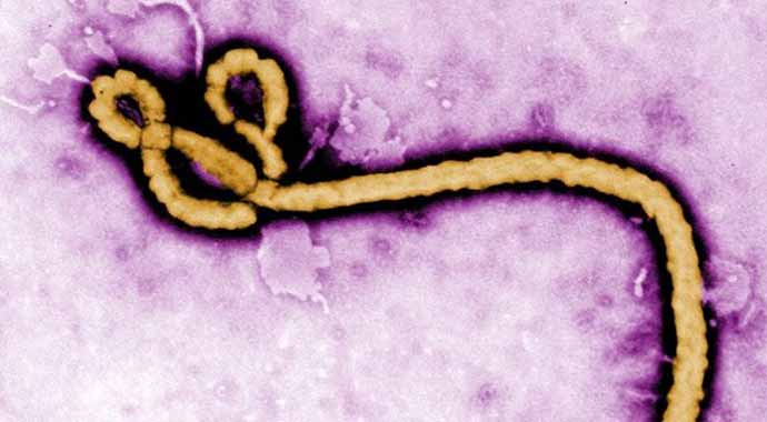Ebola virüsü nedir? İstanbul'da Ebola paniği