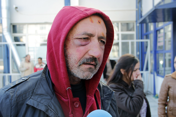 Genç kız babasını darp edenlerin iş yerini bastı!