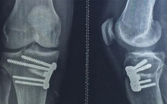 Rivaldo 43 yaşında ilk ameliyatını oldu