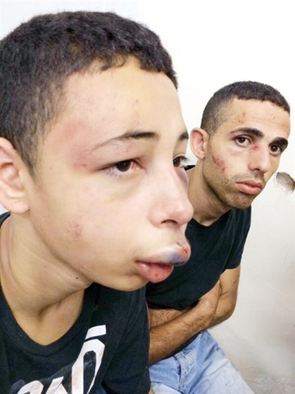 Yakılarak öldürülen Filistinlinin kuzenine inanılmaz işkence