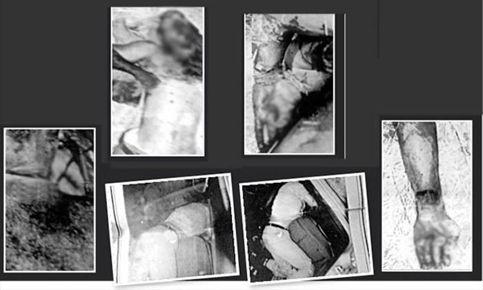 ASELSAN mühendisinin ölümüyle ilgili çarpıcı fotoğraflar