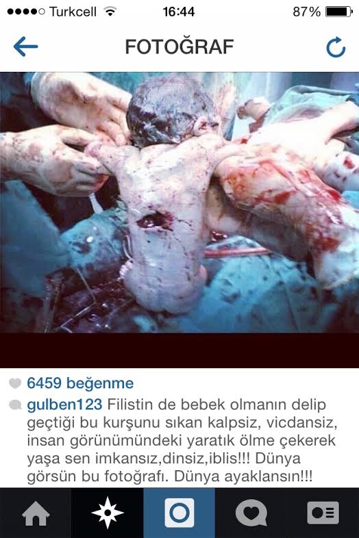 Gülben Ergen'den Gazze hassasiyeti