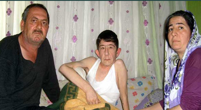 Daha 16 yaşında ama...Milyonda bir görülen hastalık onu buldu