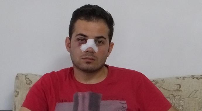 Kırmızı kart gösteren hakemin burnunu kırdı