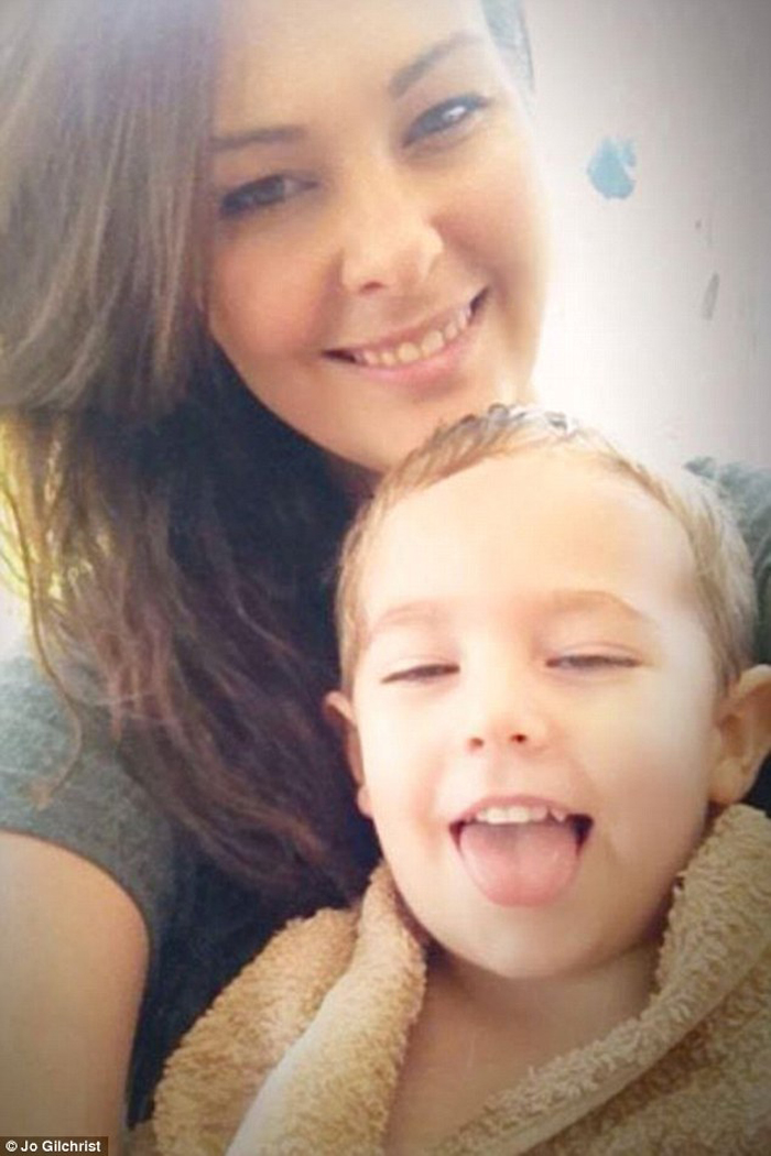 Sivilcesini makyajla kapatmak isterken kötürüm oldu