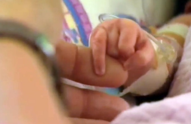 Tıp tarihine geçen doğum: 'İki yüzlü ikiz bebek'