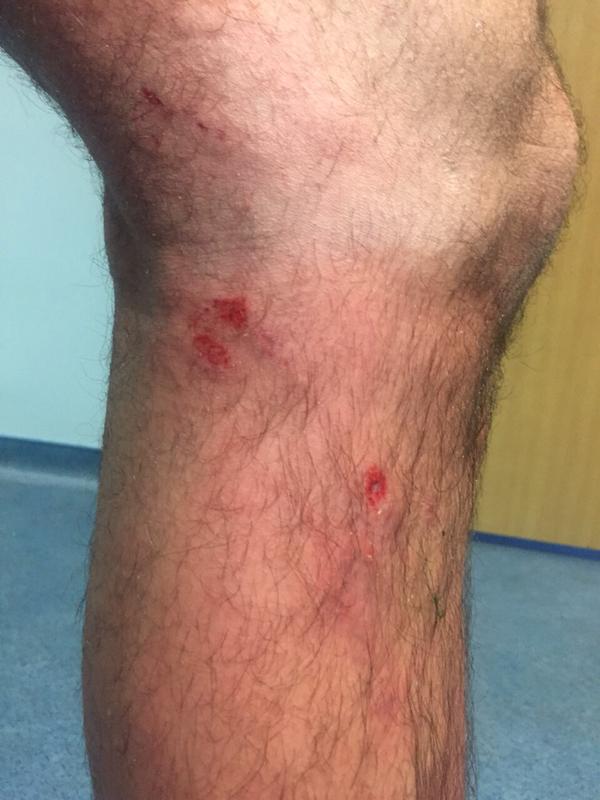 Fenerbahçe'den fotoğraflı isyan!