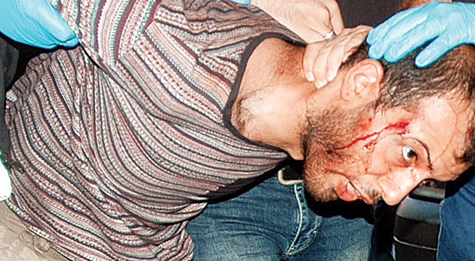 DHKP-C'den Dolmabahçe'ye ikinci saldırı