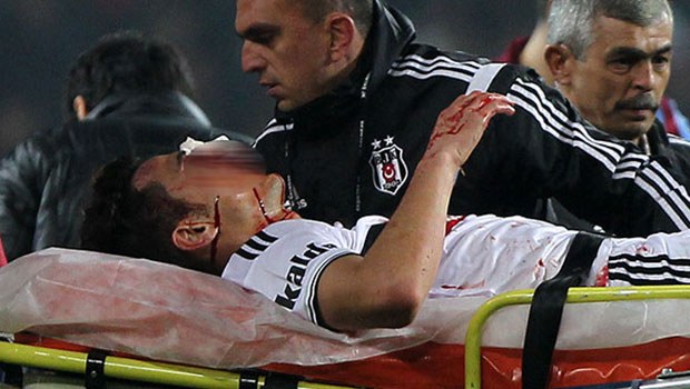 Mustafa Pektemek ameliyat olacak! Son sağlık durumu nasıl?
