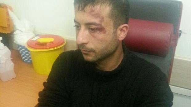 Kılıçdaroğlu'na saldırı, Bekir Bozdağ olayını hatırlattı
