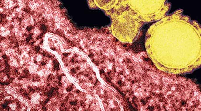 Mers ve Ebola Virüsü nedir? Detaylı bilgi