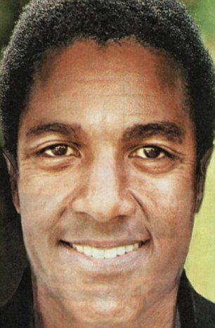 İşte Michael Jackson'ın estetik hikâyesi