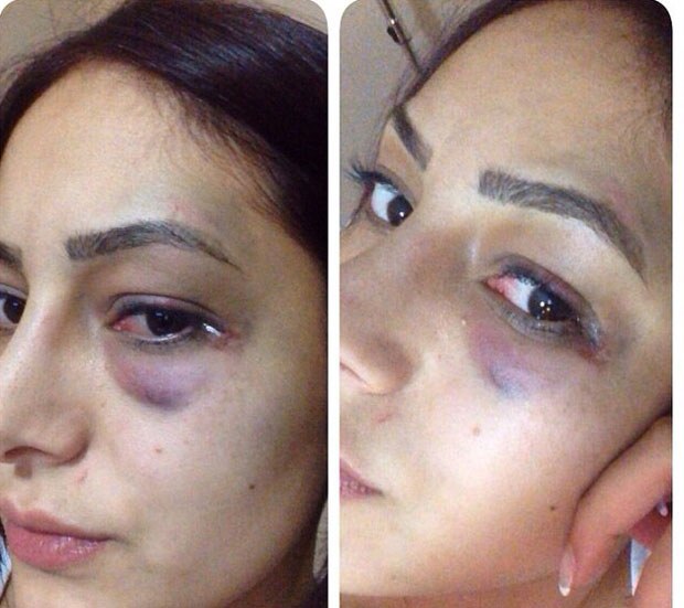 Nil Burak'ın oğlu davalık oldu!