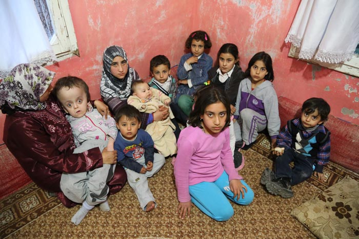 Vücudu 9 başı, 11 kilo!