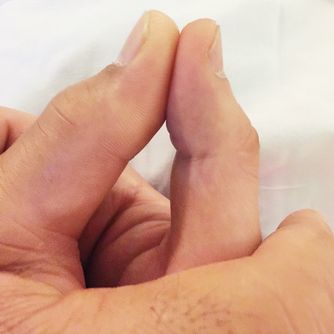 İşte İbrahim Tatlıses'in ameliyat sonrası ilk fotoğrafı