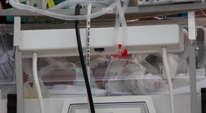 Isınsın diye yenına saç kurutma makinesi konulan bebek yandı
