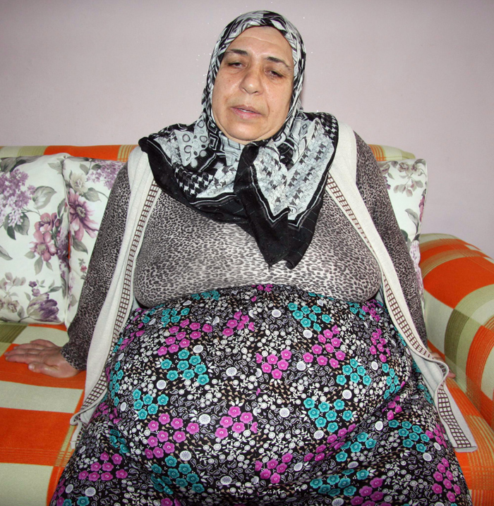 Bağırsakları dışarıda yaşıyor!