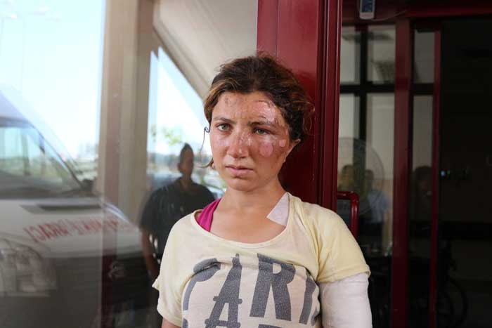 Diyarbakır'da HDP mitingindeki saldırıda yaralananlar oy kullandı