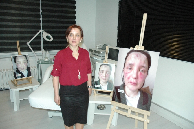 Sahte doktor kurbanı kadının yüzü tanınmaz hale geldi