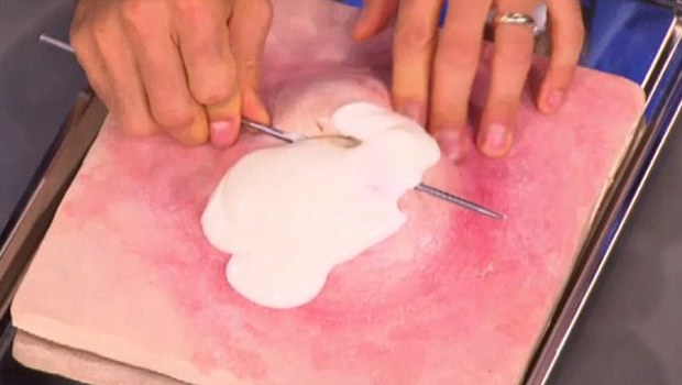 Mehmet Öz'den sivilce önerisi!