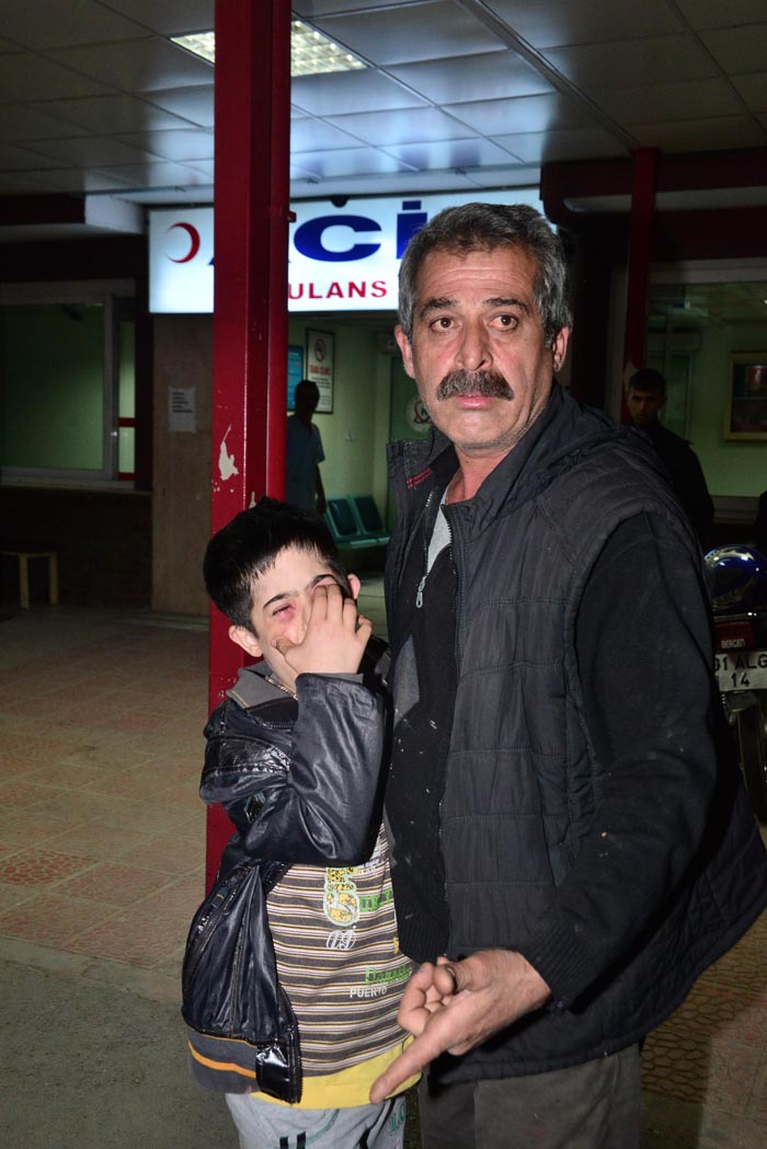 Down sendromlu Şakir eve bu halde geldi!
