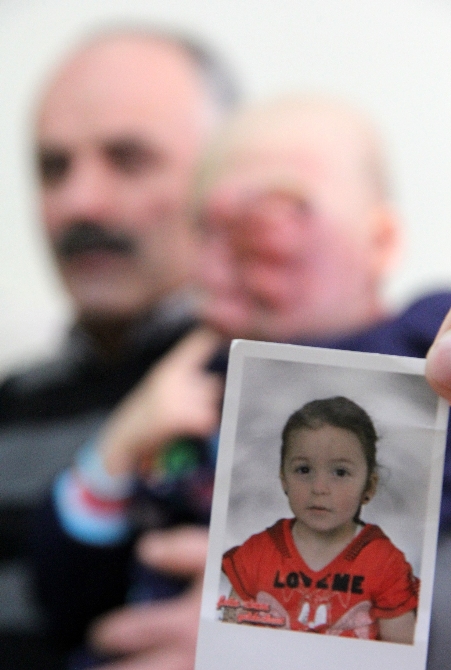 Küçük bir sivilce minik kızın hayatını kararttı