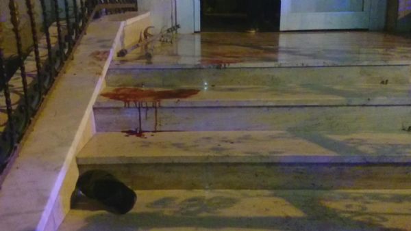 Engellinin isyan ettiren ölümü! Evinin önünde otururken...