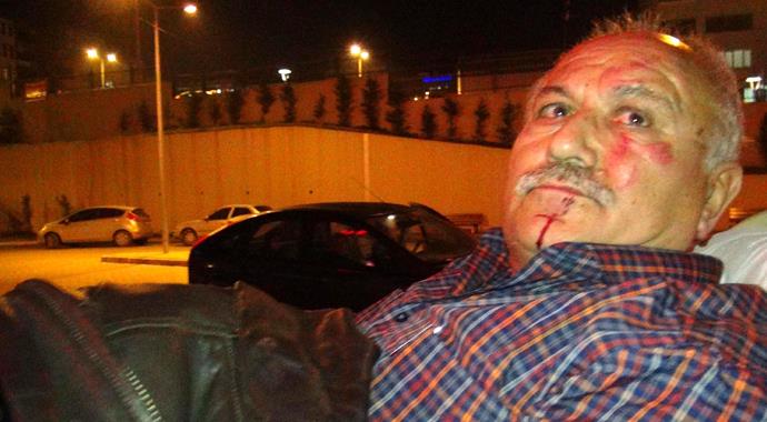 Babasını hastanelik etti