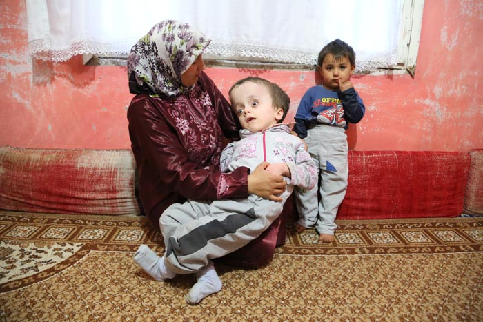 Vücudu 9 başı, 11 kilo!